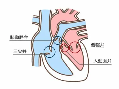 弁膜症